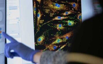 New drug candidate offers hope to slow down MND progress