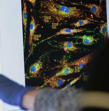 New drug candidate offers hope to slow down MND progress