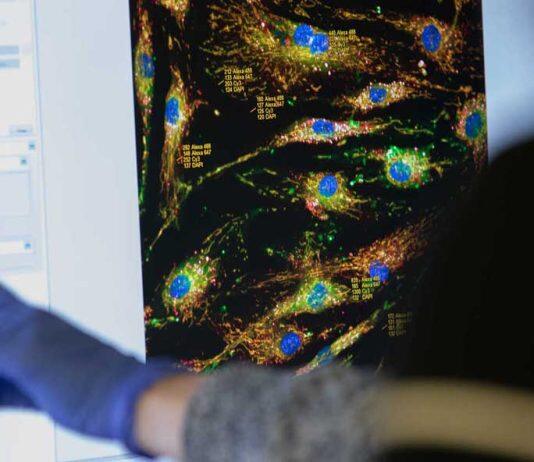 New drug candidate offers hope to slow down MND progress