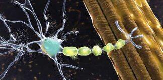 World-first NHS trial to transform care for people with motor neurone disease